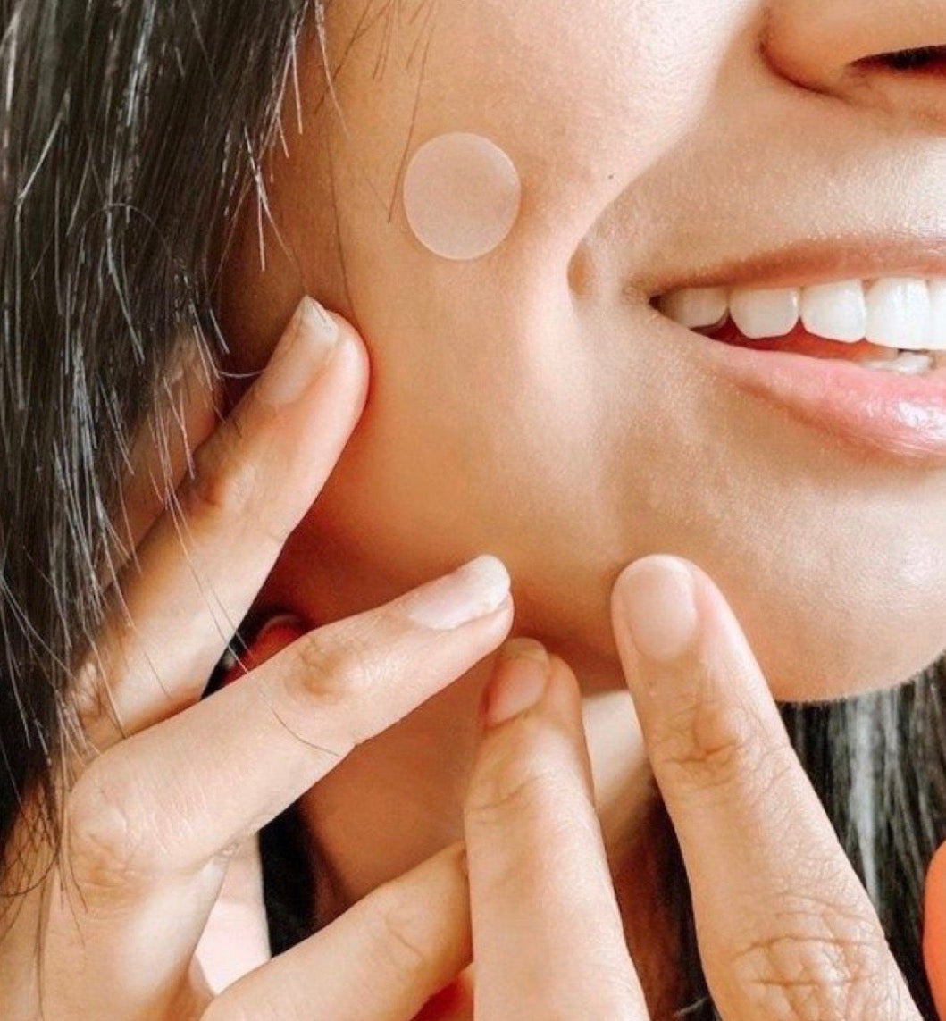 Acne Patch – 36 Hydrocolloid Patches | Overnight Pimple Healing Stickers